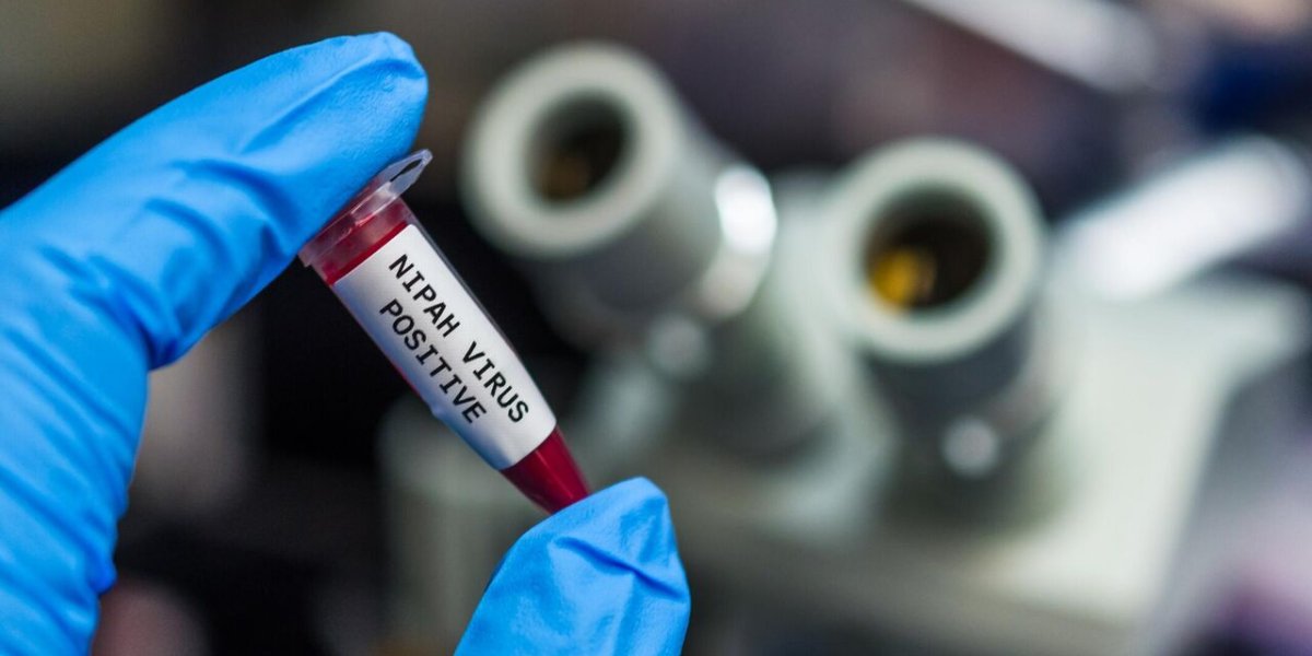 Кровь из глаз и десен: смертельный вирус Марбург добрался до туристов, ученые бьют тревогу Кровь из глаз и десен: смертельный вирус Марбург добрался до туристов, ученые бьют тревогу